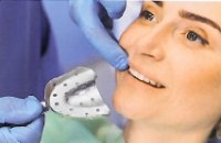 Teeth Whitening Process