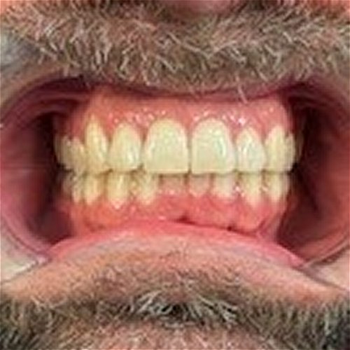 Orthodontics - after